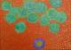 Art object - MRSA (2010)